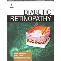 Diabetic Retinopathy (Inbunden, 2015)